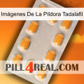 Imágenes De La Píldora Tadalafil cialis3